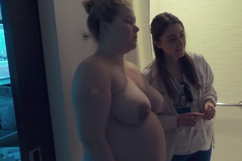 Amy schumer the fappening