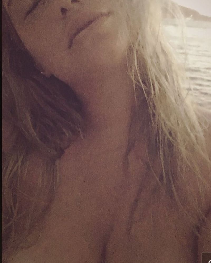 Kesha toples